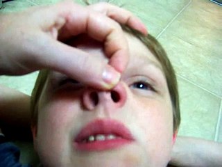 LEGO Stuck in Child's NOSE! Mothers have your Kids Watch THIS!