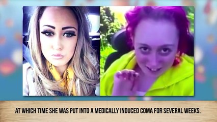 Shocking Before-And-After Drug Use Photos (2)