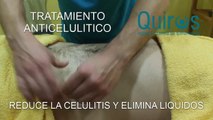 QUIROS | Tratamiento Anticelulítico