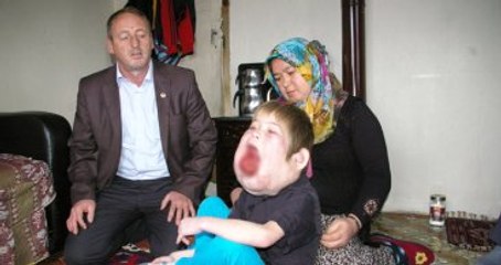 Başbakanlığın Sahip Çıktığı Küçük Çocuk Ameliyat Oldu