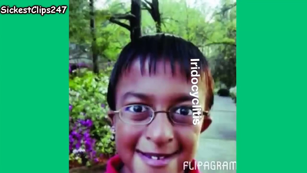 Iridocyclitis Vines Compilation - Spelling Bee Kid - Best Vine Remix