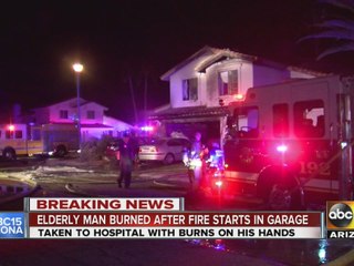 Elderly man burned after fire starts in garage