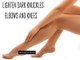 How to Get Rid of Dark Elbows and Knees Quickly - Effective Tips To Get Rid Of Black Knees And Elbow