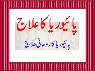 Pyorrhea Ka Rohani ilaj - Pyorrhea Ka Ilaj - Danton Ke Warm Aur Msorhon ka Ilaj