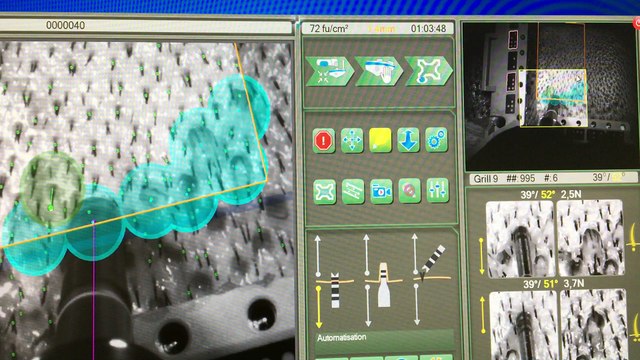 Suivi commande du robot Artas procédure de 3000 greffons The_clinic Paris