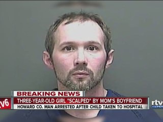 3-year-old girl "scalped" by mom's boyfriend