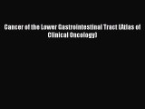 Read Cancer of the Lower Gastrointestinal Tract (Atlas of Clinical Oncology) Ebook Free