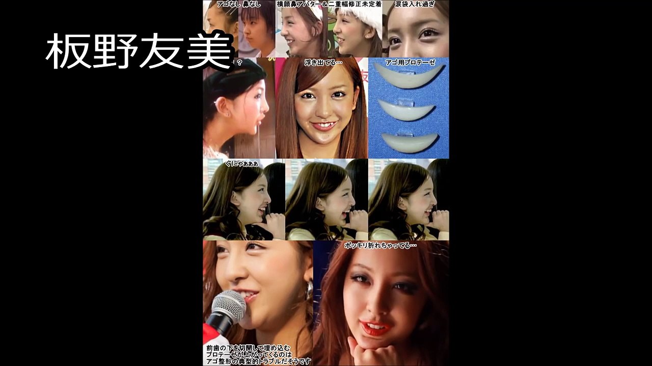 整形を失敗して変になってしまった芸能人まとめ
