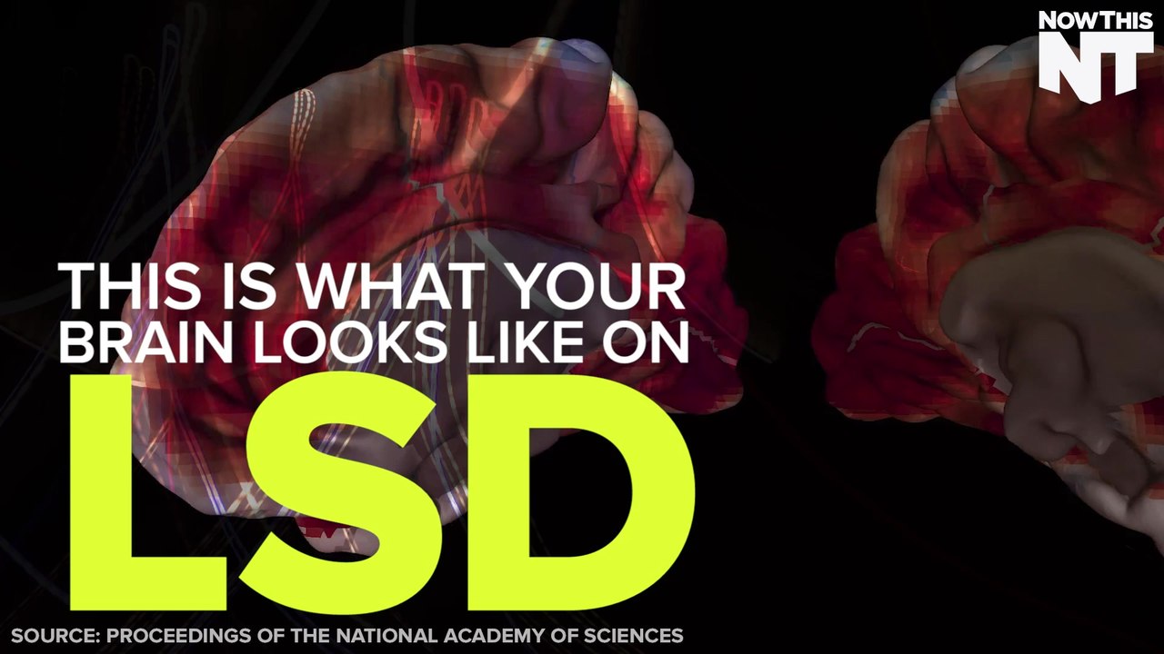 This Is Your Brain On LSD