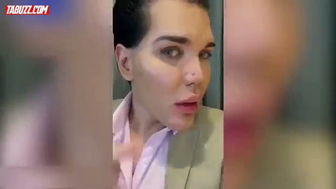 Rodrigo Alves nous montre le trou qui est apparu dans son nez