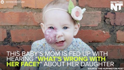 Mom Celebrates Daughter's Birthmark To Change The Conversation About Looking "Different"