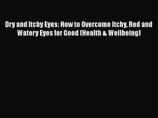 Read Dry and Itchy Eyes: How to Overcome Itchy Red and Watery Eyes for Good (Health & Wellbeing)