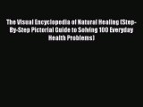 Read The Visual Encyclopedia of Natural Healing (Step-By-Step Pictorial Guide to Solving 100