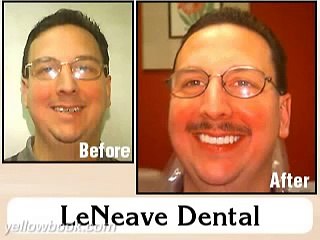 LeNeave Dental - Jefferson County, KY