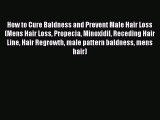 Download How to Cure Baldness and Prevent Male Hair Loss (Mens Hair Loss Propecia Minoxidil