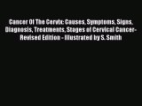 [PDF] Cancer Of The Cervix: Causes Symptoms Signs Diagnosis Treatments Stages of Cervical Cancer-