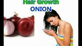 ONIONS CAN STIMULATE HAIR GROWTH PROVEN FACT_PIYAZ SE GANGAY PAN KA ELAJ.