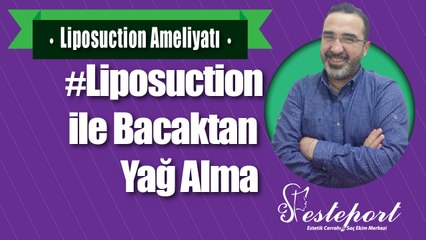 Liposuction ile Bacaktan Yağ Alma & Esteport Klinik