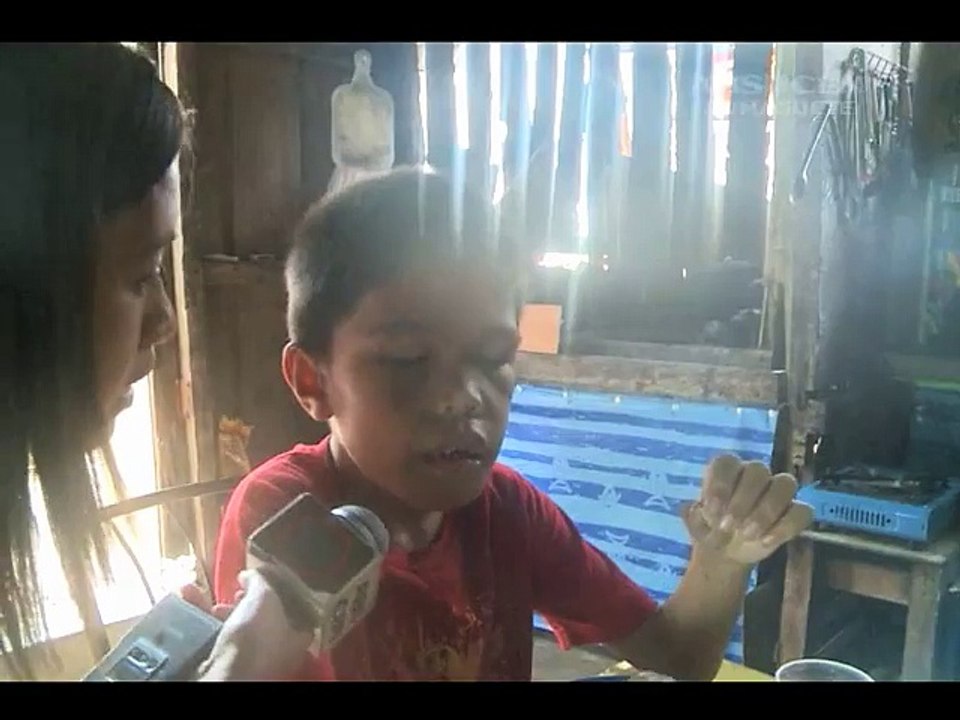 9-year-old boy from Cebu has 300 teeth