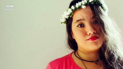 Microcephaly patient: I survived - BBC News