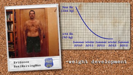 Gastric Bypass Time Lapse  Amazing 170 lbs weight loss transformation #2