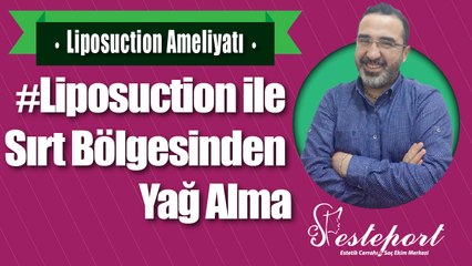 Liposuction ile Sırt Kısmından Yağ Alma & Esteport