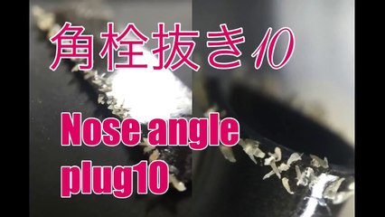 不思議な角栓登場〜鼻角栓10！100 cut beyond! Pull out the nose Blackheads.