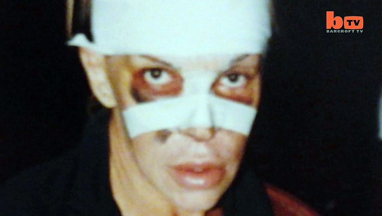 Surgery Obsessive Spends $76,000 In Quest For Perfection