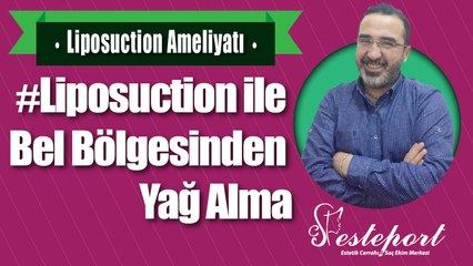 Liposuction ile Bel Çevresinden Yağ Alma & Op Dr Ali Mezdeği