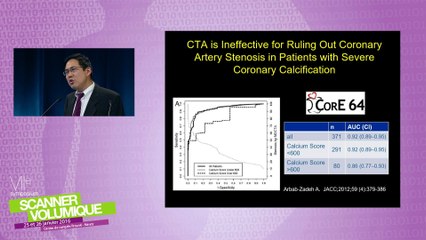 Coronary subtraction - Cutting Edge in cardiac imaging