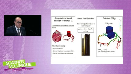 Perfusion cardiaque sous stress - Cutting Edge in cardiac imaging