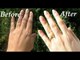 Best Home Remedies to Remove Sun Tan Naturally I‎How to Maintain a Clear Skin