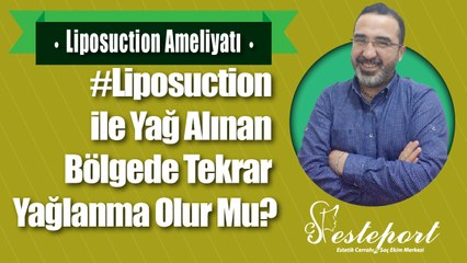 Liposuction Sonrası Tekrar Yağlanma Olur Mu