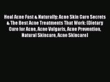 Download Heal Acne Fast & Naturally: Acne Skin Care Secrets & The Best Acne Treatments That