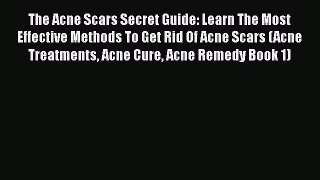 Read The Acne Scars Secret Guide: Learn The Most Effective Methods To Get Rid Of Acne Scars