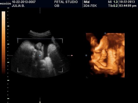 Utah 3d and 4d Prenatal and ultrasound Imaging Center