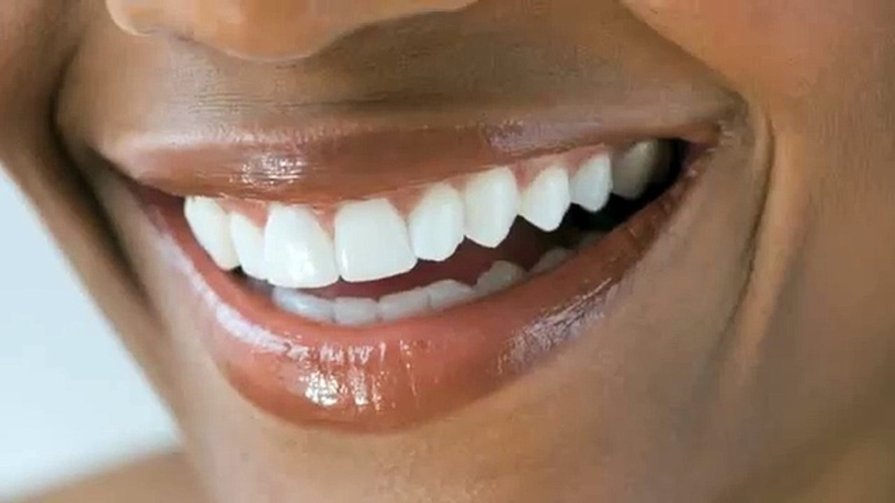 Watch - Professional Teeth Whitening Review/Chat - The White Smile Company