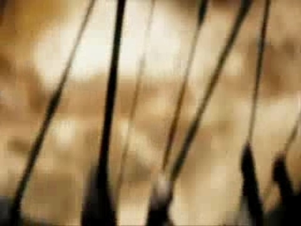 300