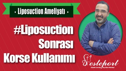 Liposuction Sonrası Korse Kullanımı