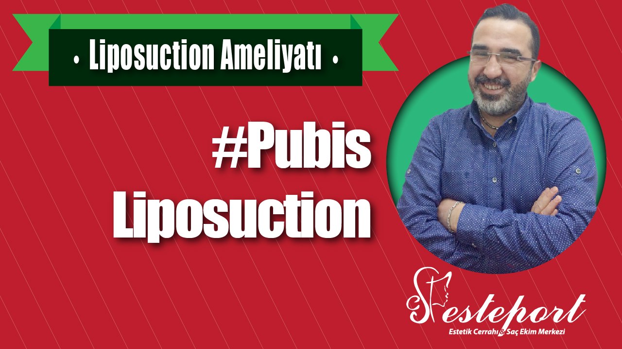 Pubis Liposuction