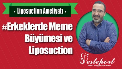 Erkeklerde Popo Kalça Küçültme