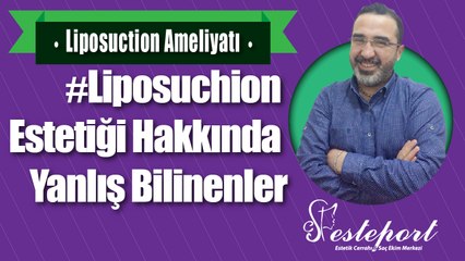 Liposuction Ameliyatı; Doğru Bilinene Yanlışlar
