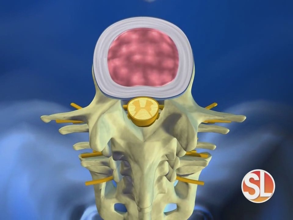 AZ Pain Centers offers spinal pain treatments