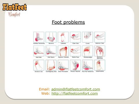 Running With Flat Feet