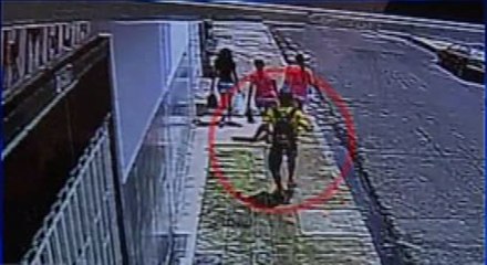 Caso mujer atacada con ácido