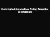 PDF Dental Implant Complications: Etiology Prevention and Treatment PDF Book Free