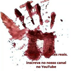 Fogos estoura na mão de homem