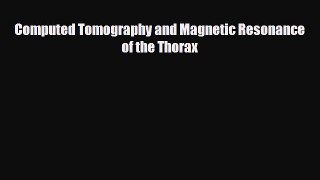 Download Computed Tomography and Magnetic Resonance of the Thorax [Read] Full Ebook