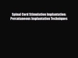 [Download] Spinal Cord Stimulation Implantation: Percutaneous Implantation Techniques [Download]