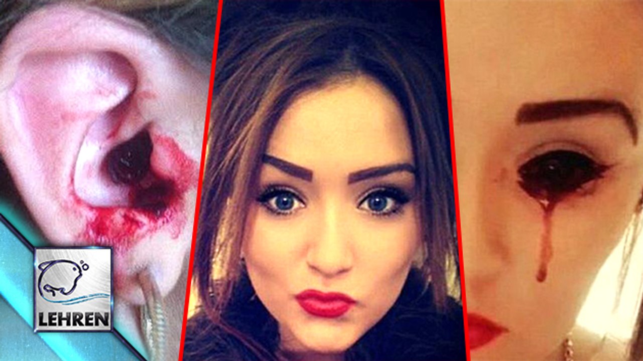 Girl Bleeds From Eyes, Ears, Fingers, and Scalps. WHY? | SHOCKING